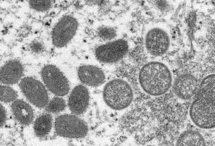 Monkeypox ou variole du singe : mesures préventives