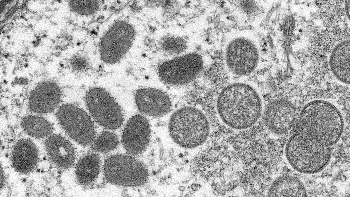 Monkeypox ou variole du singe : mesures préventives