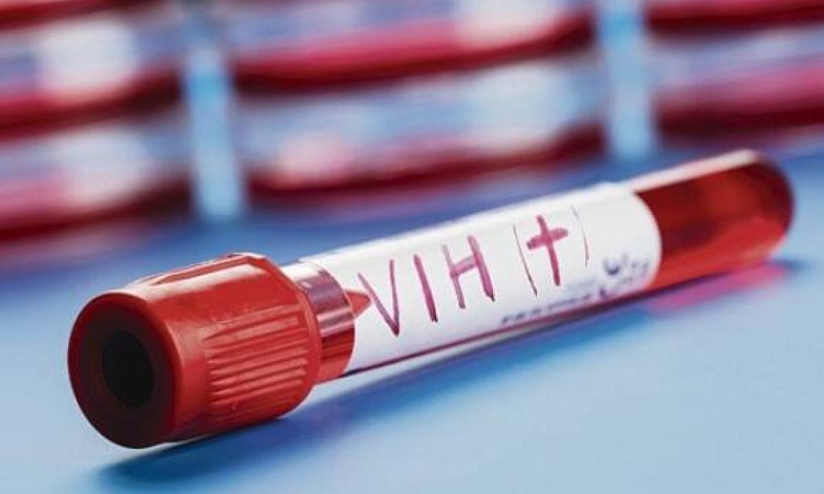 Santé : nouveau cas de guérison du VIH après une greffe de moelle osseuse