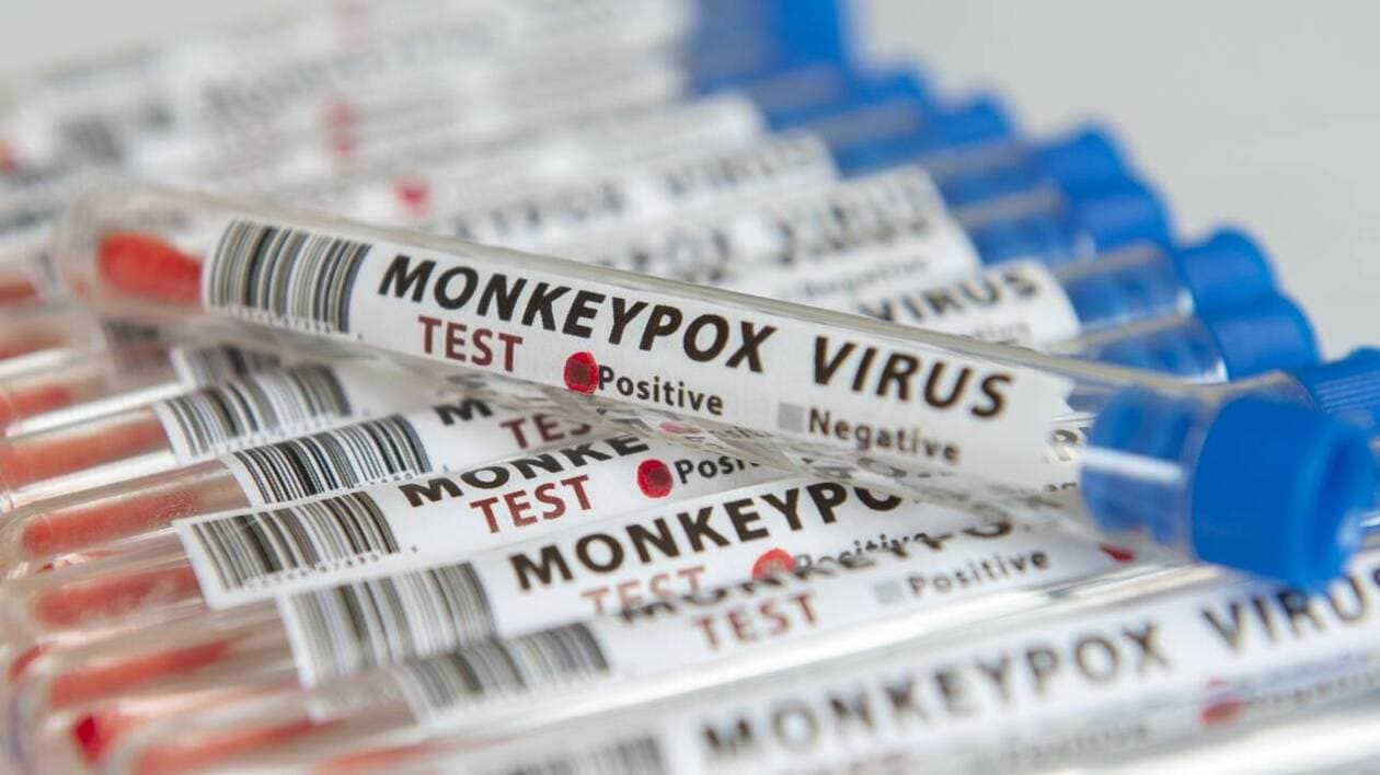 La Chine détecte une nouvelle souche mutée du virus mpox